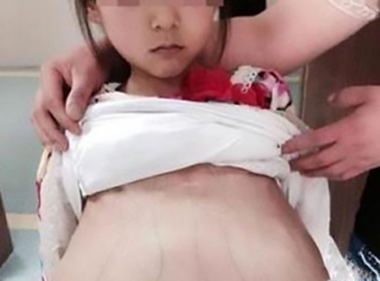 【狂気】妊娠させられた性奴隷の少女（12歳）をご覧ください・・・（画像あり） ポッカキット