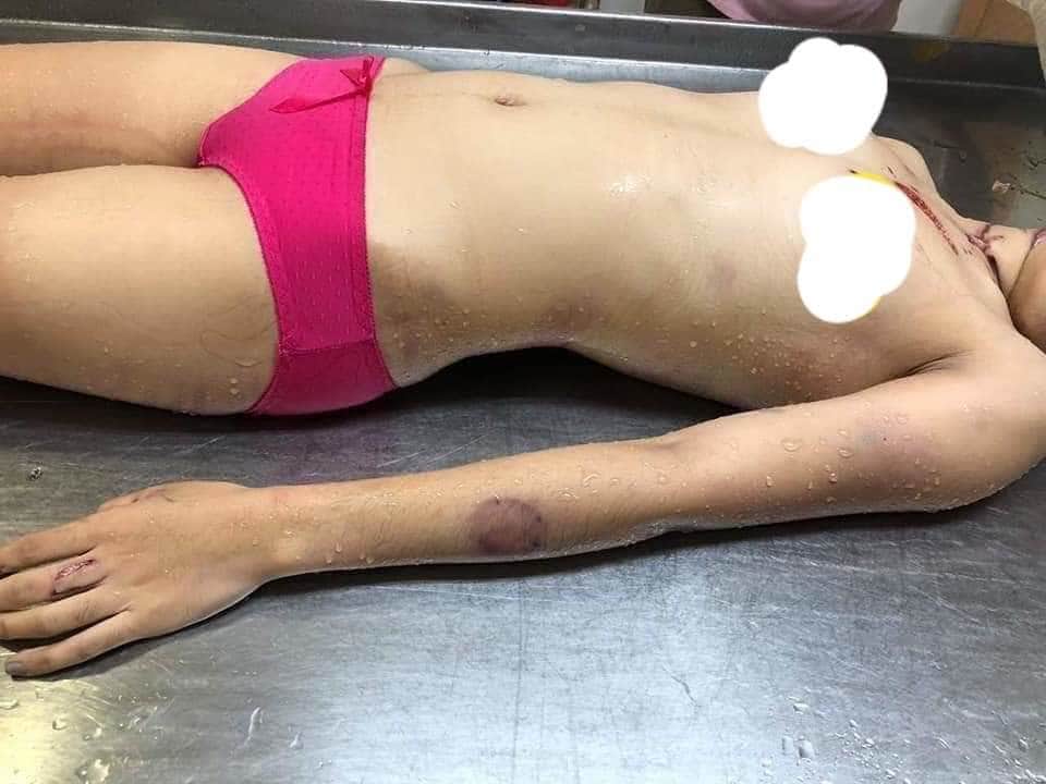 【閲覧注意】男に襲われた22歳の女性。裸にしたら・・・（画像あり） ポッカキット