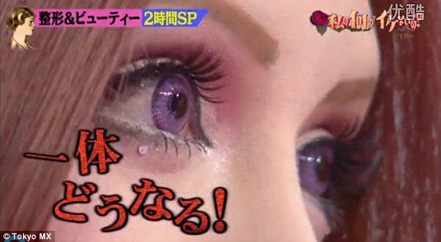 japanese_woman_gets_plastic_surgery_09-